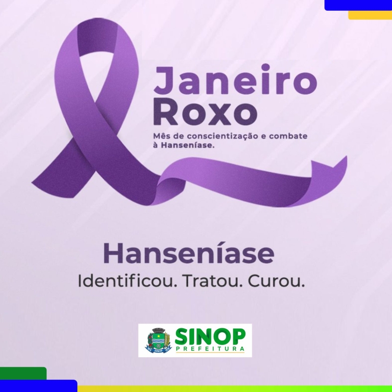 Janeiro Roxo: Prefeitura de Sinop intensifica as ações de combate à Hanseníase