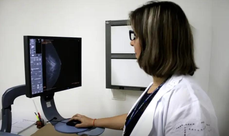 Entidades médicas pedem faixa etária maior para mamografia de rastreio