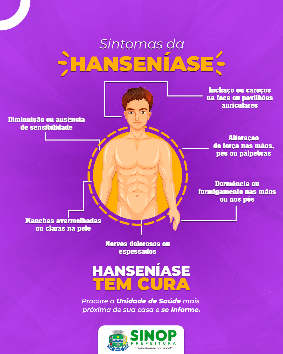 Coordenador esclarece dúvidas sobre Hanseníase